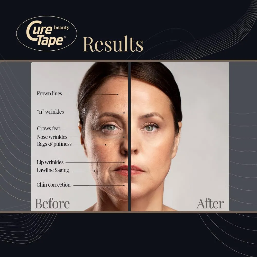 CureTape Beauty Kinesiology Tape | Anti-Wrinkle Face Tape | Face Lift Tape for Toning, Firming & Tightening The Skin | Kinesiology Tape for Face and Sensitive Skin | Soft on The Skin (2'' X 16')