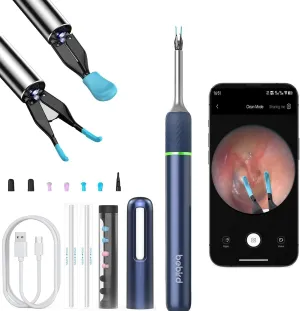 Note5 Ear Wax Tweezers with Camera, 10MP Ear Cleaner Camera Otoscope with Light,Real-time Remote Video with Ear Pick & Tweezers,12 Pcs Ear Scoops for Whole Family